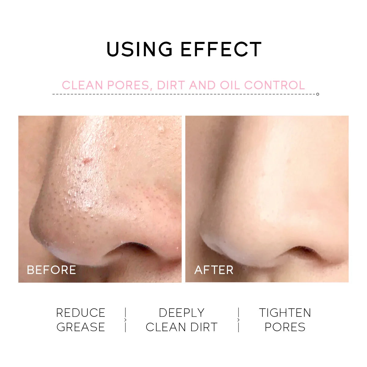 Sakura Peeling Nose Mask