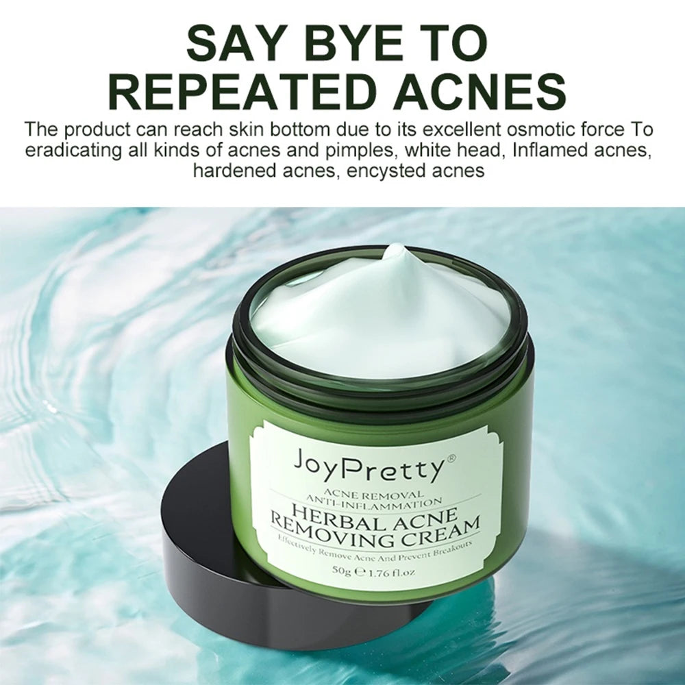 JoyPretty Acne Treatment